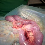 Pyometra mit linkem Ovar (zystisch entartet)